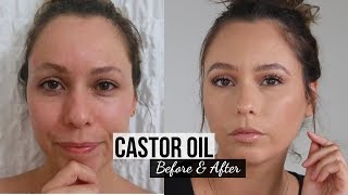 30 Days of Castor Oil For Eyebrow Growth [upl. by Aketal]