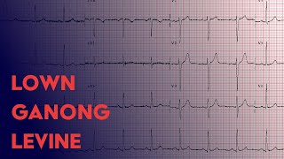 Lown Ganong Levine  ECG EKG Interpretation [upl. by Alleen]