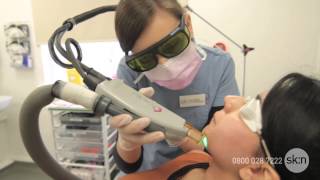 Laser Hair Removal  How does it work [upl. by Maryrose]