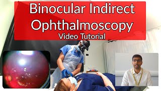 Approach to Fundoscopy  Ophthalmoscopy [upl. by Anel826]