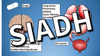 SIADH EXPLAINED Hyponatraemia [upl. by Ardnu]