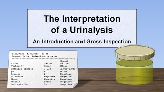 Interpretation of the Urinalysis Part 1  Introduction and Inspection [upl. by Cecily]