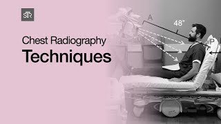 Chest Radiography Techniques [upl. by Missi]