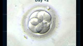 EMBRYO DEVELOPMENT UP TO BLASTOCYST [upl. by Jorie]