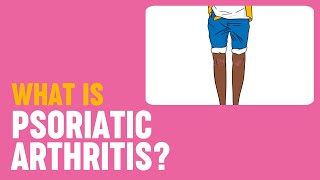 What is psoriatic arthritis [upl. by Huan]