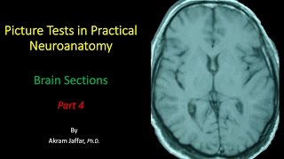 Picture Test in Neuroanatomy Brain Sections 4 [upl. by Kaia]