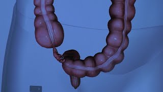 The Anatomy of the Appendix [upl. by Kikelia431]